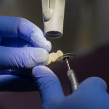 Differenze tra endodontista e ortodontista